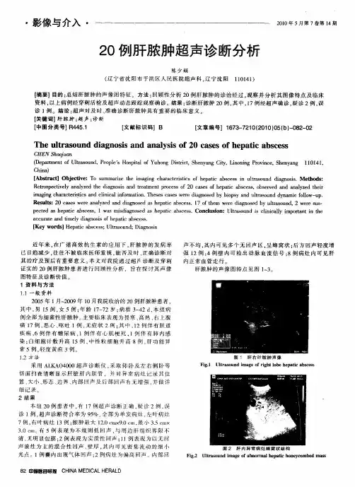 20例肝脓肿超声诊断分析