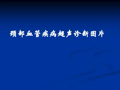 全系颈动脉疾病B超诊断图解