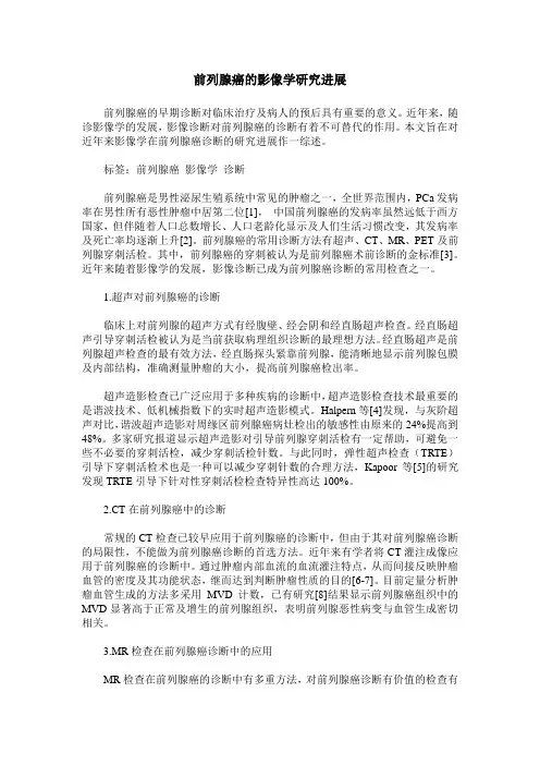 前列腺癌的影像学研究进展