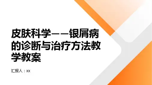 皮肤科学——银屑病的诊断与治疗方法教学教案