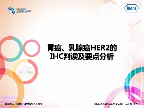 HER2的IHC判读和要点分析