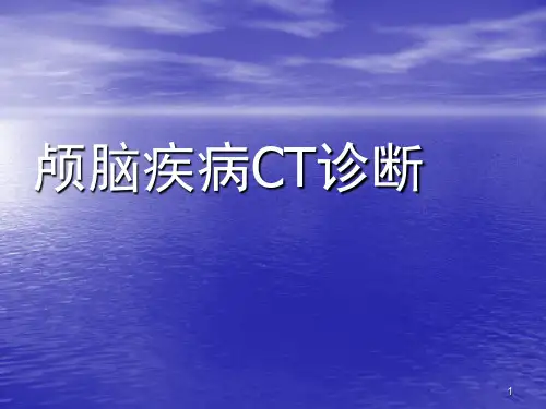 颅脑疾病CT诊断