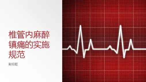 椎管内麻醉镇痛的实施规范