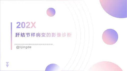 肝脏结节样病变影像诊断