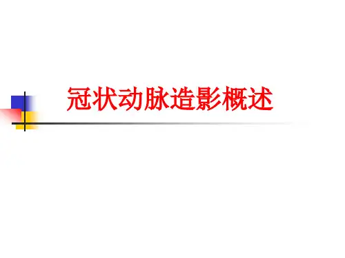 冠状动脉造影