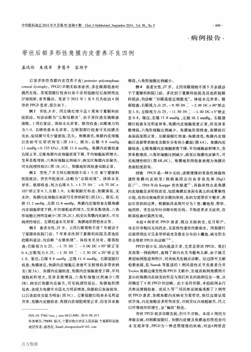 带状后部多形性角膜内皮营养不良四例