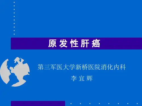 原发性肝癌