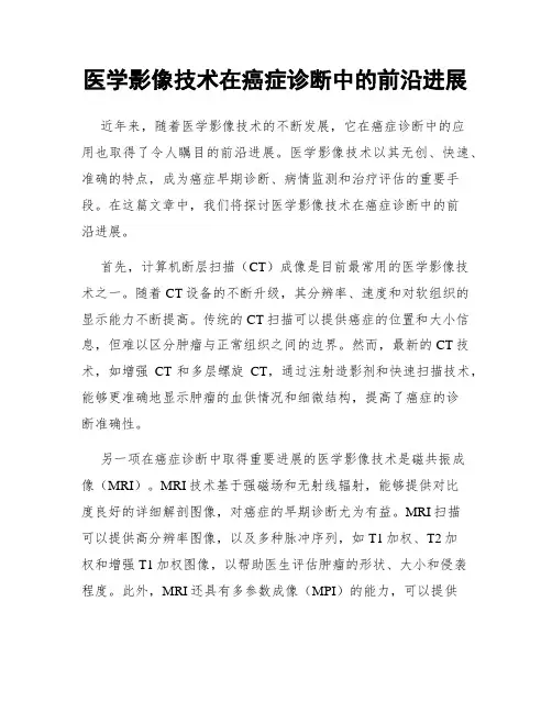 医学影像技术在癌症诊断中的前沿进展
