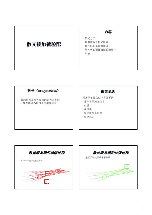 散光接触镜验配