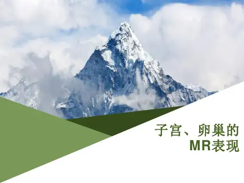 子宫、卵巢的MR表现