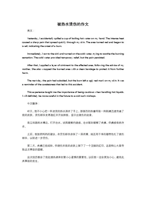 被热水烫伤的作文