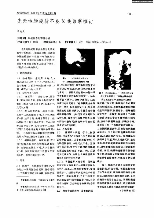 先天性肠旋转不良X线诊断探讨
