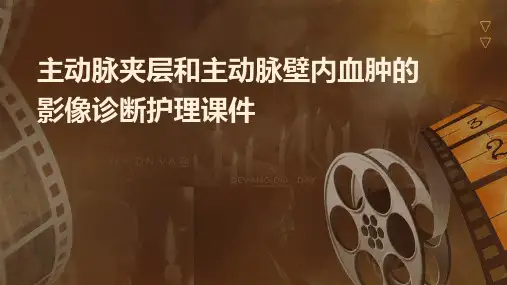 主动脉夹层和主动脉壁内血肿的影像诊断护理课件
