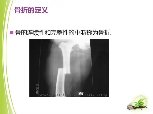 骨折及骨折内固定术后护理ppt课件