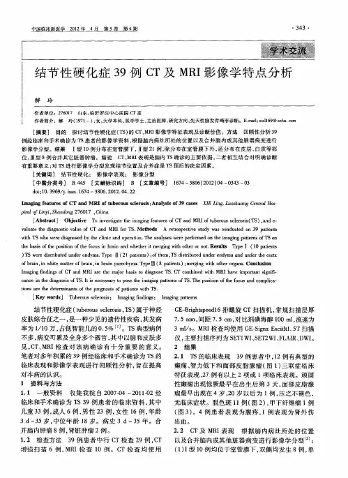 结节性硬化症39例CT及MRI影像学特点分析
