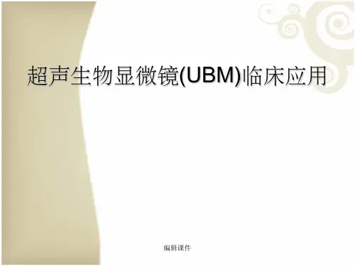 超声生物显微镜(UBM)临床应用