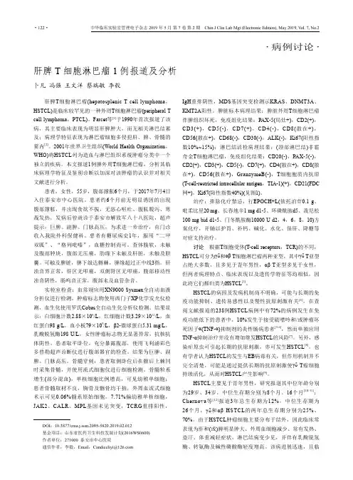 肝脾T细胞淋巴瘤1例报道及分析