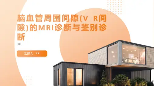 脑血管周围间隙(V R间隙)的MRI诊断与鉴别诊断