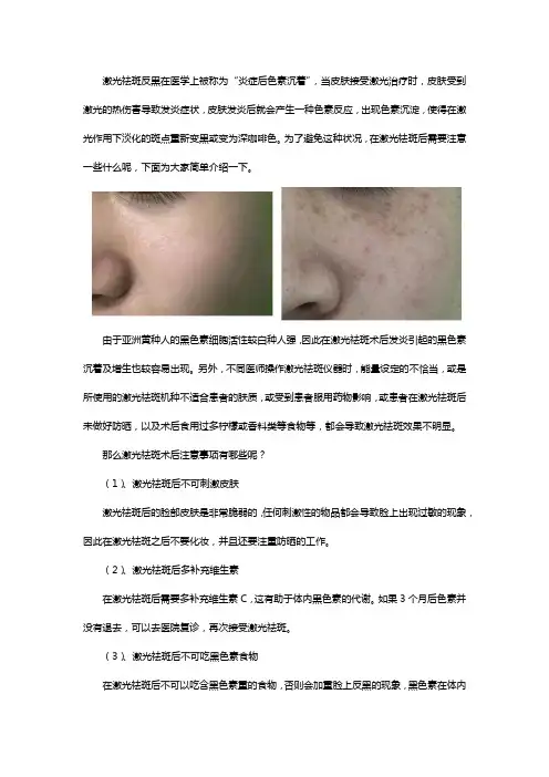 激光祛斑不能吃什么