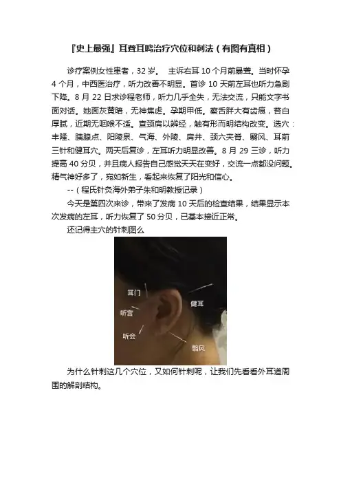 『史上最强』耳聋耳鸣治疗穴位和刺法（有图有真相）