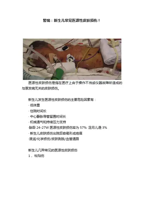 警惕：新生儿常见医源性皮肤损伤！