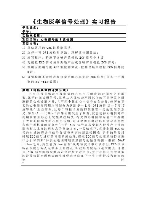 (完整word版)matlab心电信号R波检测