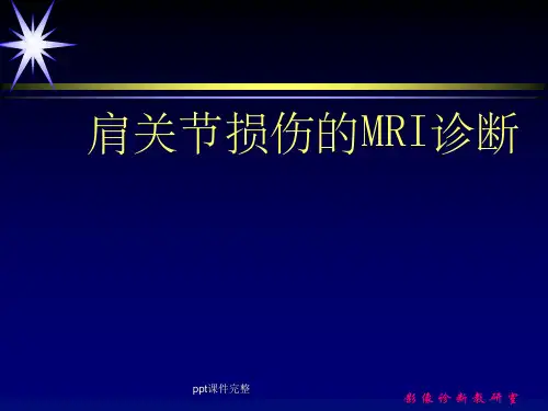 肩关节损伤的MRI诊断ppt课件