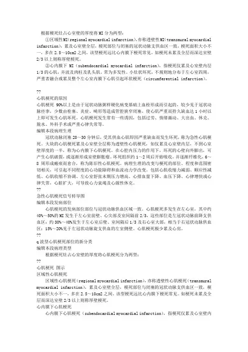急性心肌梗死