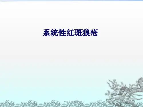 系统性红斑狼疮ppt课件