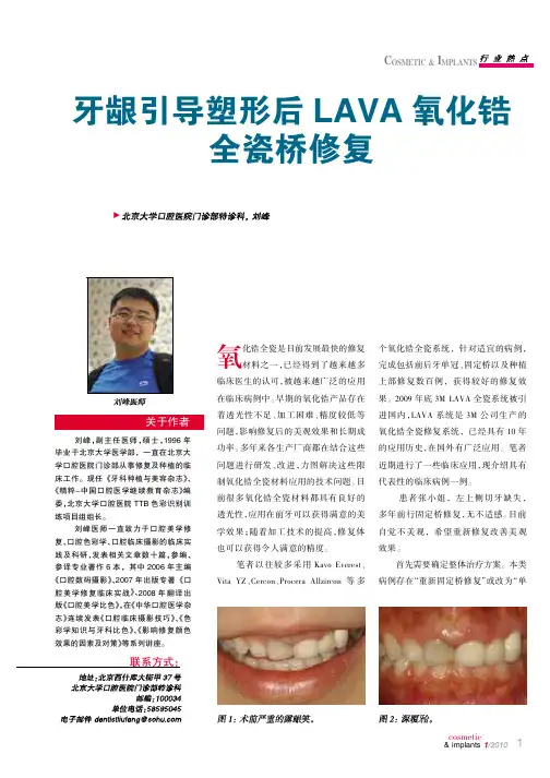牙龈引导塑形后LAVA氧化锆 全瓷桥修复