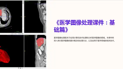 《医学图像处理课件：基础篇》