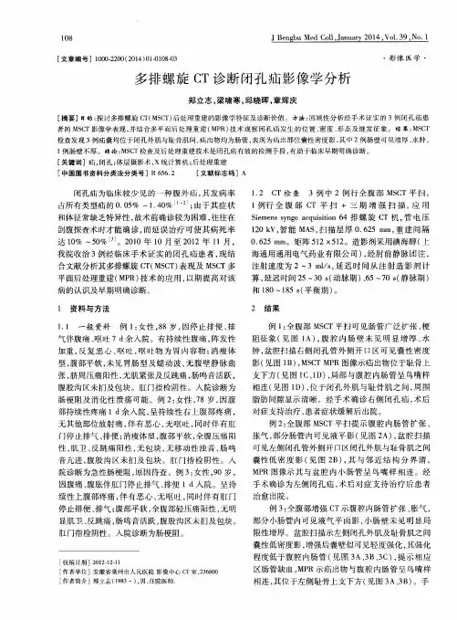 多排螺旋CT诊断闭孔疝影像学分析