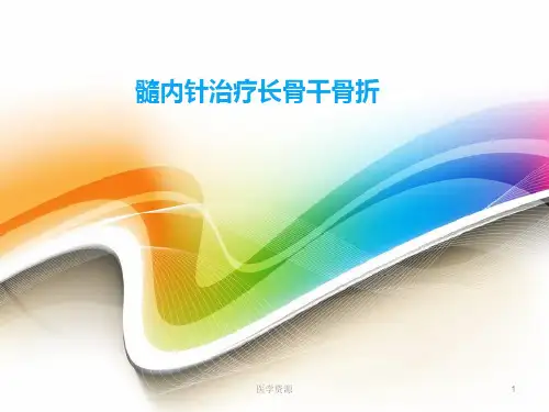 髓内钉治疗长骨干骨折  ppt课件