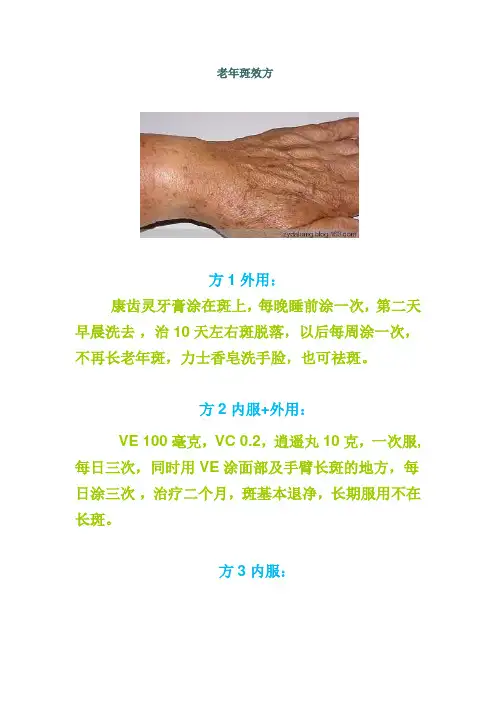 老年斑治疗方法