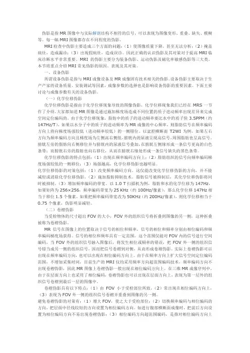 磁共振伪影