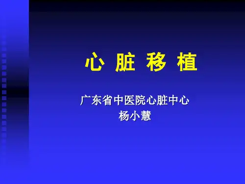心脏移植