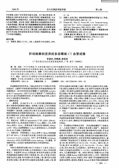 肝动脉解剖变异的多层螺旋CT血管成像