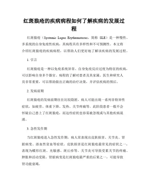 红斑狼疮的疾病病程如何了解疾病的发展过程
