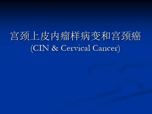 CIN和宫颈癌解读