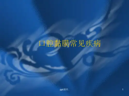 口腔黏膜常见疾病ppt课件