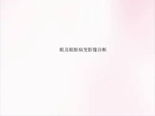 眼及眼眶病变影像医学课件