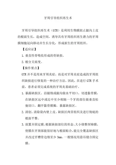牙周引导组织再生术