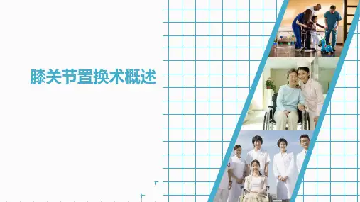 膝关节置换术概述