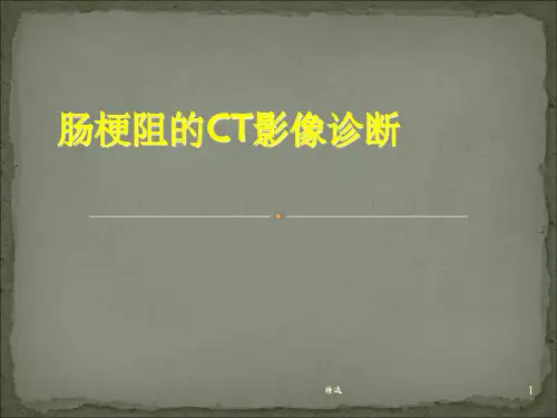肠梗阻的CT影像诊断ppt课件
