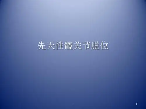 先天性髋关节脱位PPT课件