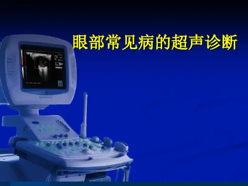 眼部常见病的超声诊断第二部分 ppt课件