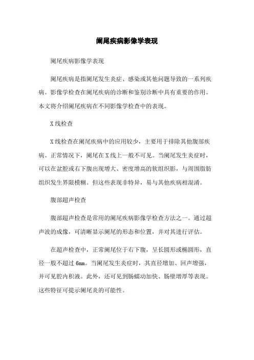 阑尾疾病影像学表现