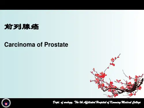 前列腺癌PPT课件