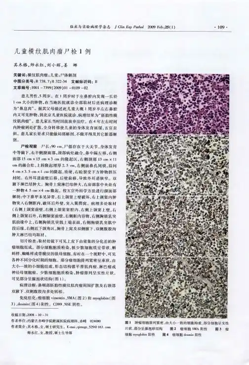儿童横纹肌肉瘤尸检1例