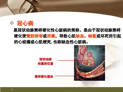心肌梗死健康宣教幻灯片精品PPT课件